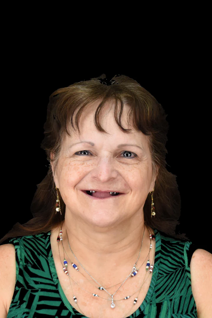 Patient Transformation 3