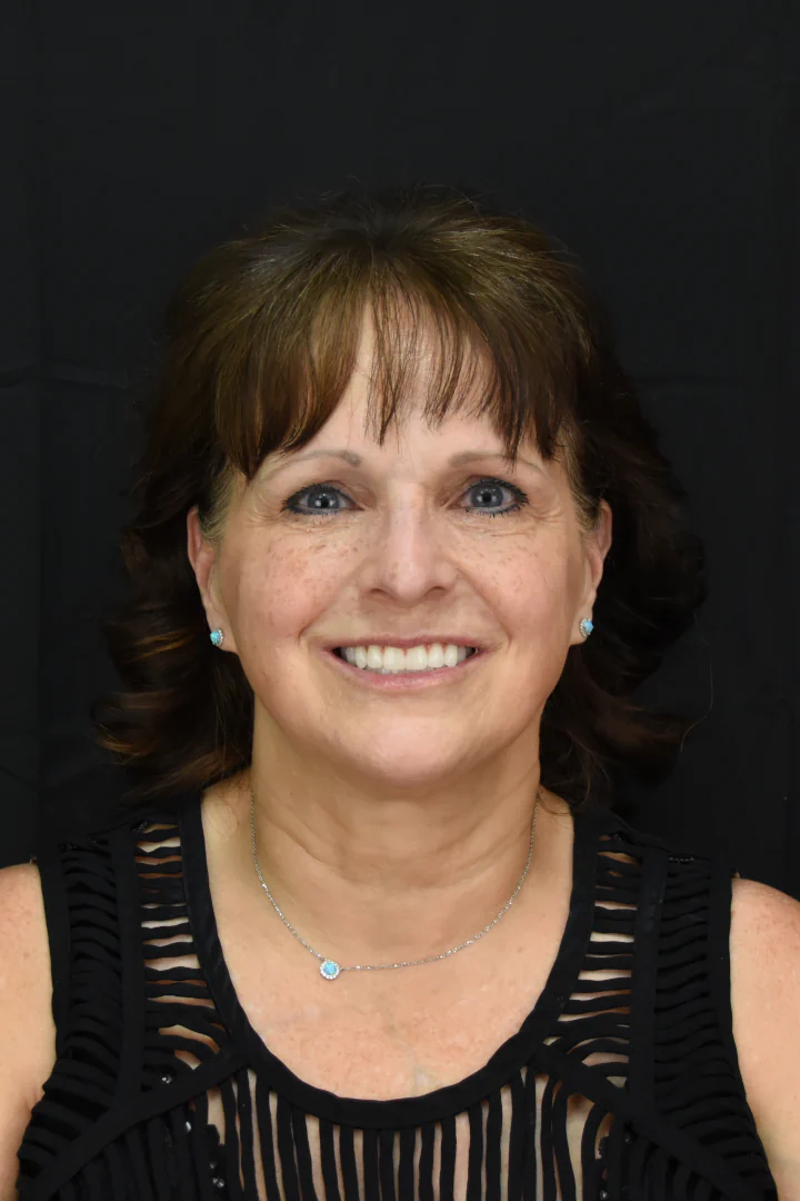 Patient Transformation 4