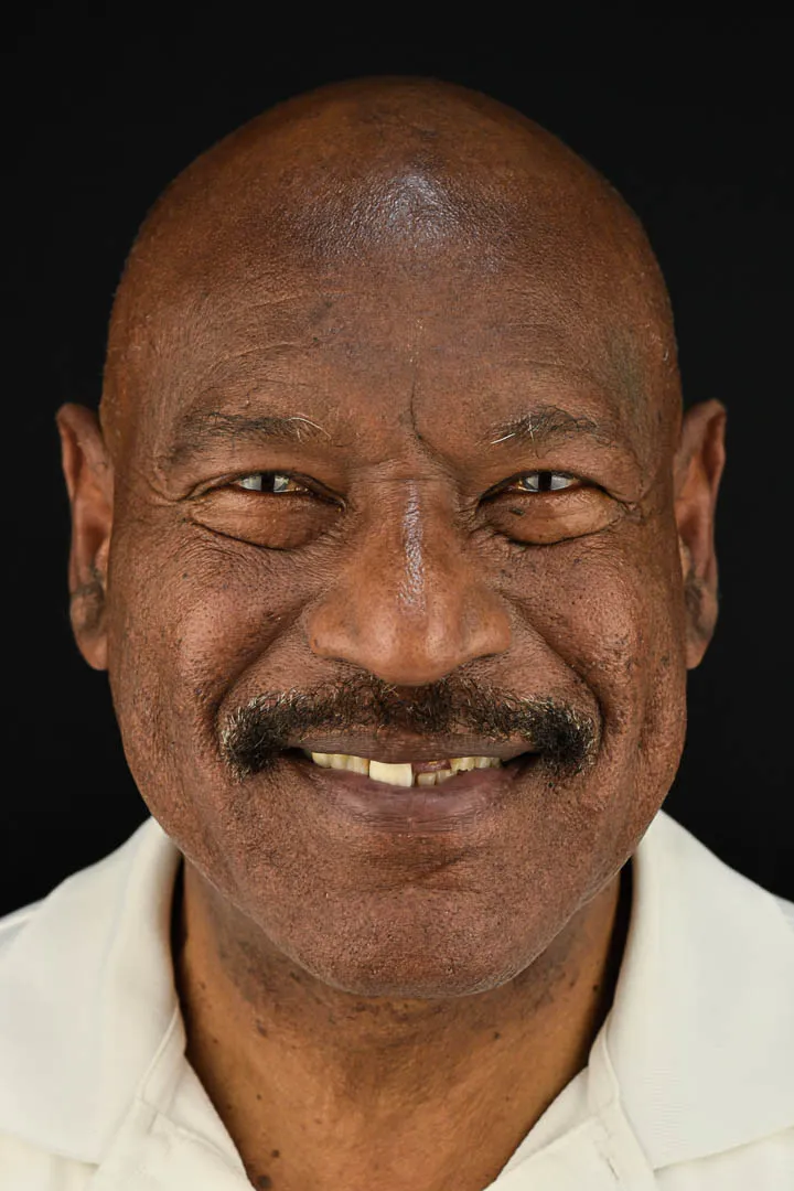 Patient Transformation 5