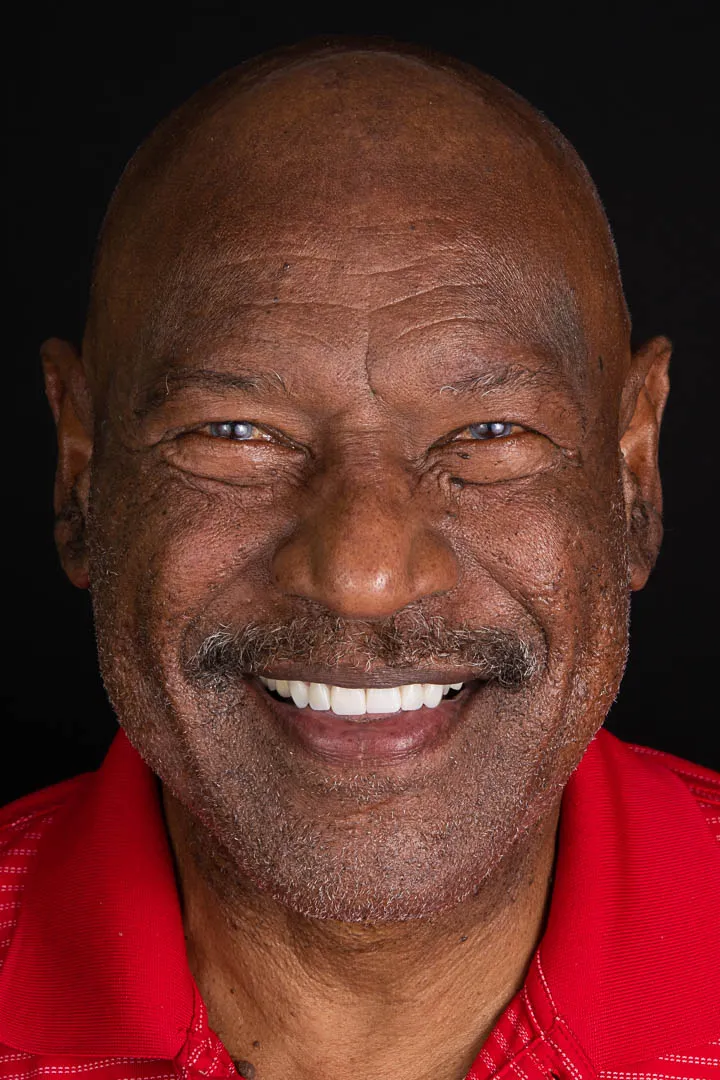 Patient Transformation 6