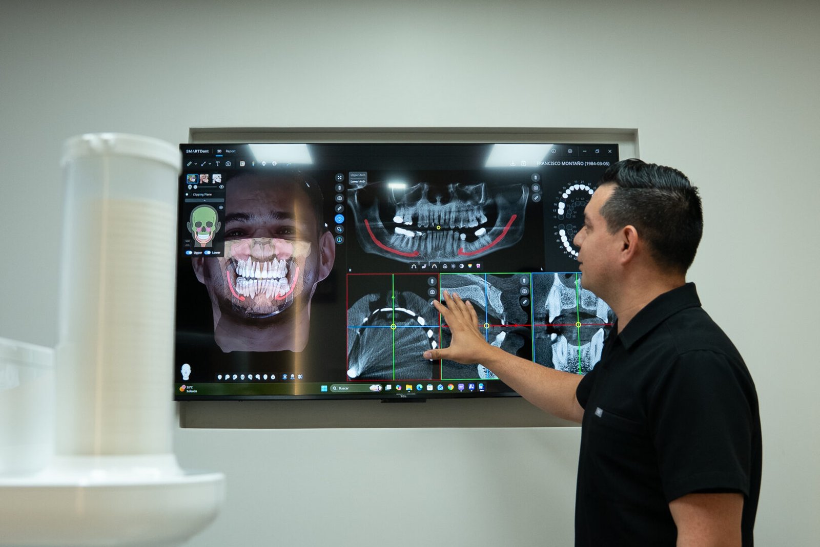 Advanced dental treatment planning with 3D imaging at Let's Smile Dentistry in Mexicali