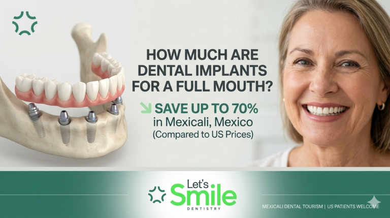 Infographic thumbnail for Let's Smile Dentistry in Mexicali, Mexico, explaining full mouth dental implants cost and how US patients can save up to 70 percent on treatment.